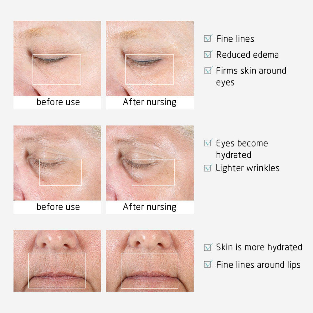 Facial Skin Lifting Anti-Wrinkle Massager